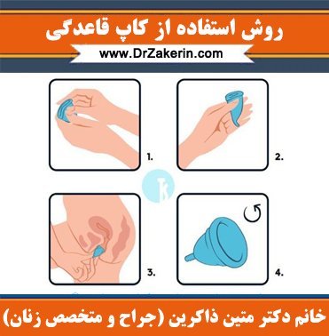 طرز استفاده کاپ قاعدگی+کاپ قاعدگی برای باکره ها