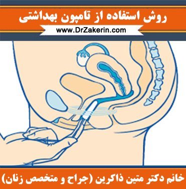  فیلم و عکس استفاده از تامپون قاعدگی