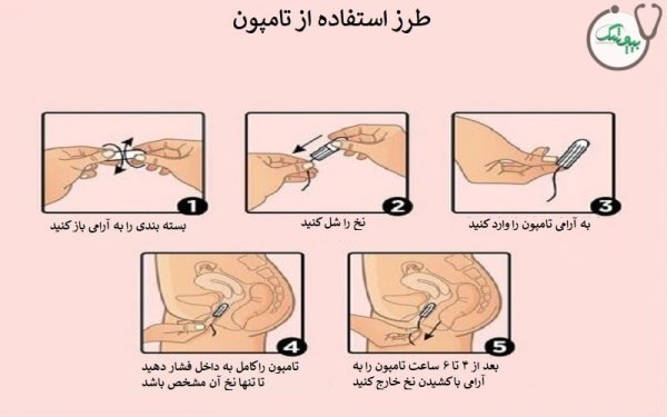  فیلم و عکس استفاده از تامپون قاعدگی
