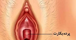  فرق پرده حلقوی و ارتجاعی