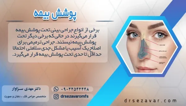  گرانترین و بهترین دکتر عمل / جراحی بینی در تهران