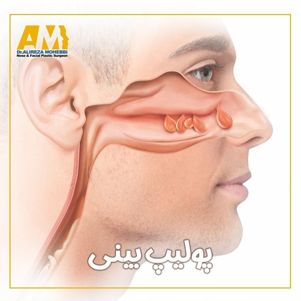  گرانترین و بهترین دکتر عمل / جراحی بینی در تهران