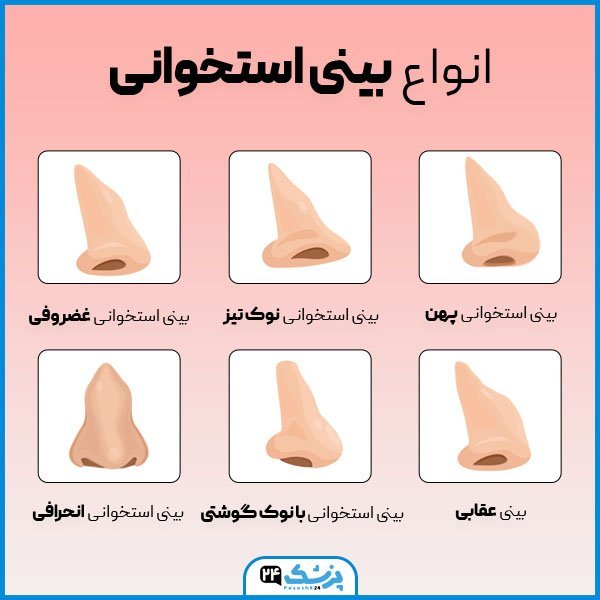  قیمت عمل / جراحی بینی در تهران ۱۴۰۴