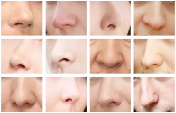 بهترین نوع عمل بینی کدام است؟