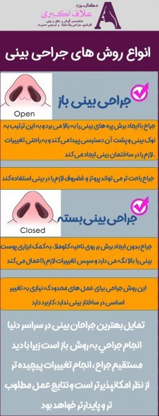  بهترین نوع عمل بینی کدام است؟