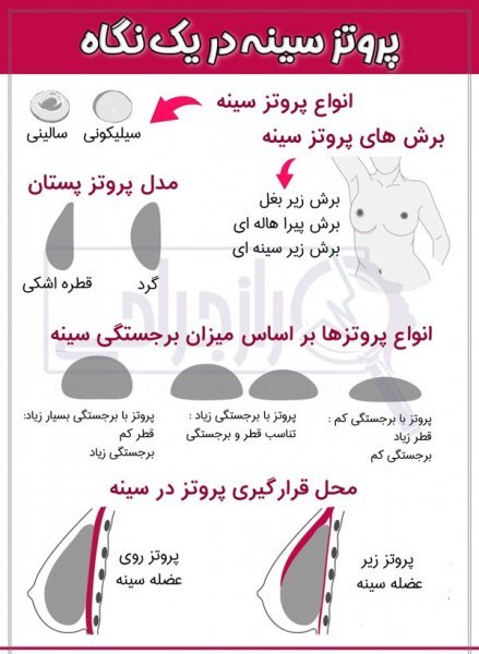  عکس و فیلم قبل و بعد پروتز سینه