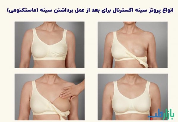  عکس و فیلم قبل و بعد پروتز سینه