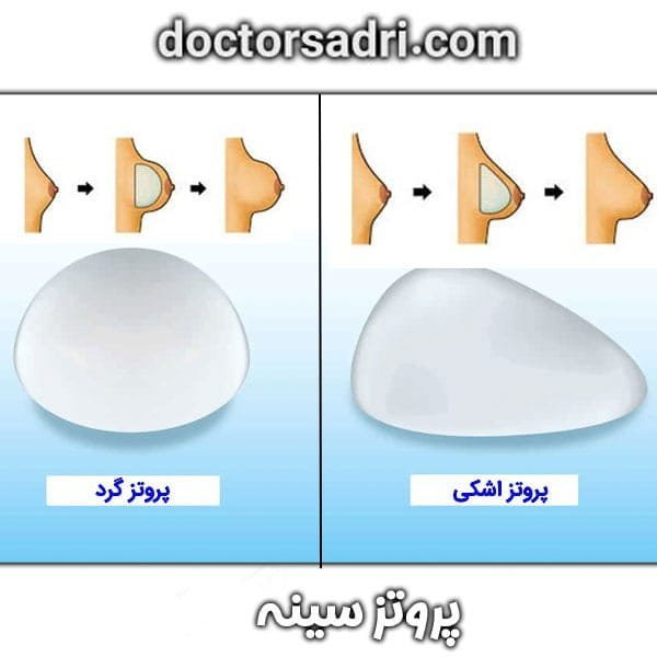 عکس و فیلم قبل و بعد پروتز سینه