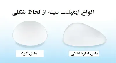  عکس و فیلم قبل و بعد پروتز سینه