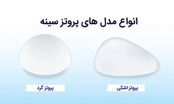  پروتز سينه اقساطي در تهران