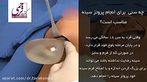  پروتز سينه اقساطي در تهران