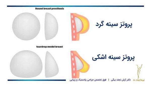  پروتز سينه اقساطي در تهران