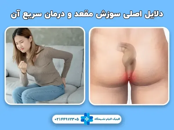  آیا رابطه مقعدی باعث زگیل تناسلی میشود؟