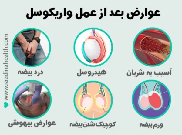  آیا عمل واریکوسل باعث اختلال نعوظ میشود؟