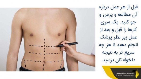  هزینه ساکشن /لیپوساکشن شکم و پهلو در تهران