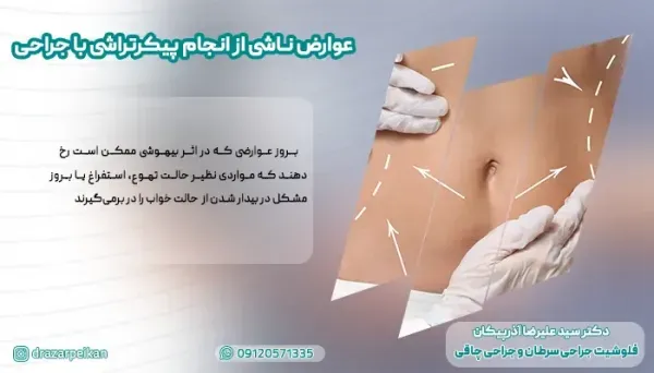  هزینه ساکشن /لیپوساکشن شکم و پهلو در تهران