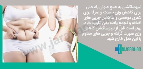  هزینه ساکشن /لیپوساکشن شکم و پهلو در تهران