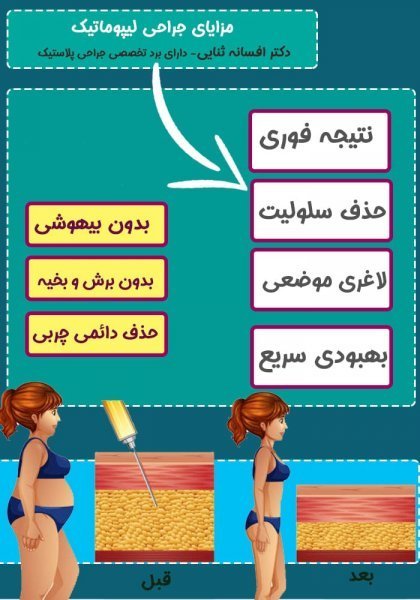  پدر لیپوماتیک ایران