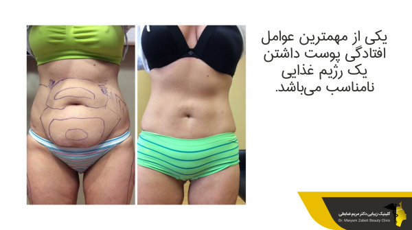  پدر لیپوماتیک ایران