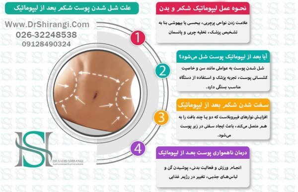  پدر لیپوماتیک ایران