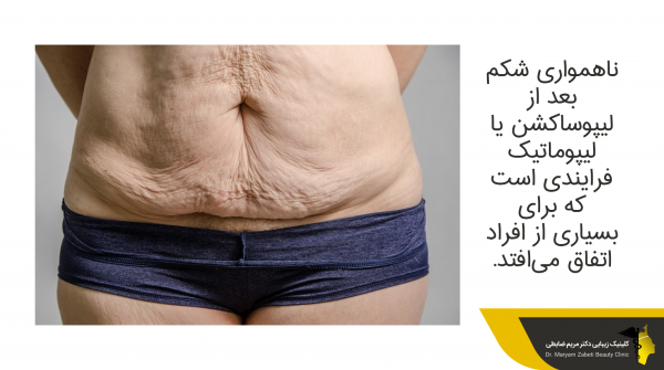  سکس /نزدیکی بعد از لیپوماتیک