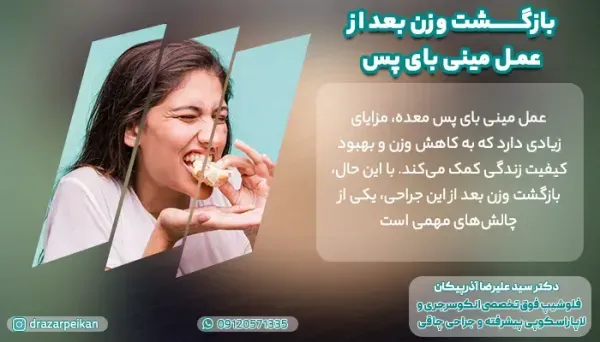  سکس/ رابطه جنسی بعد از اسلیو معده