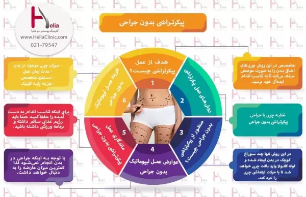  تجربیات عمل ابدو / ابدومینوپلاستی