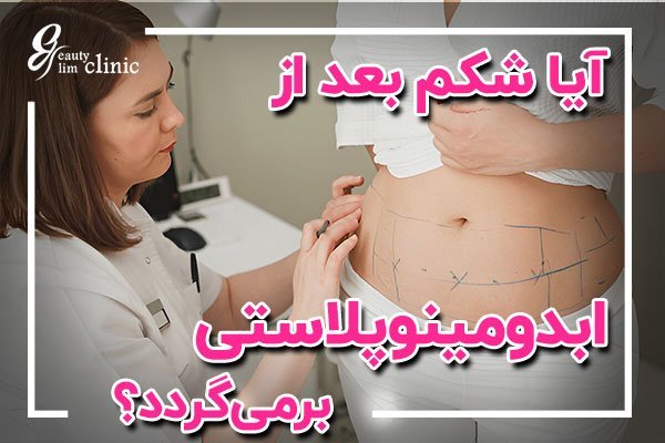  تجربیات عمل ابدو / ابدومینوپلاستی