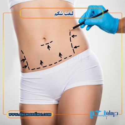  عکس لیفت شکم بدون جراحی