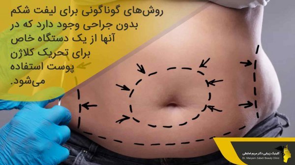  عکس لیفت شکم بدون جراحی