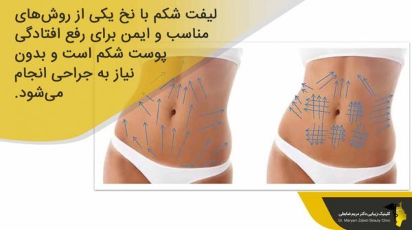 عکس لیفت شکم بدون جراحی