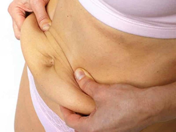  عکس لیفت شکم بدون جراحی