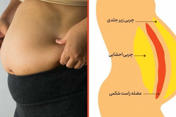  عکس لیفت شکم بدون جراحی