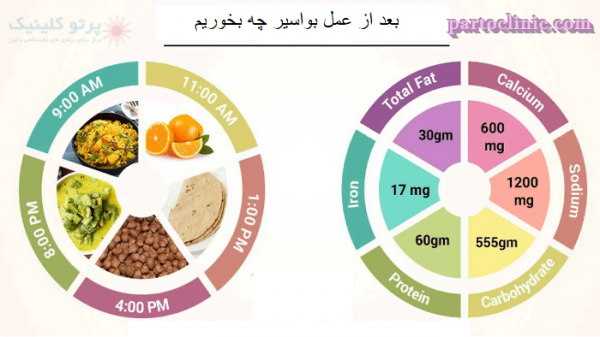  چه زمانی بواسیر نیاز به عمل دارد؟