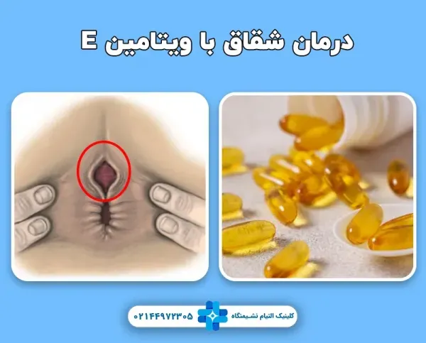  سوالات متداول عمل بواسیر