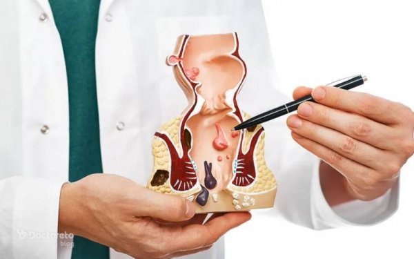 فیلم عکس عمل بواسیر هموروئید