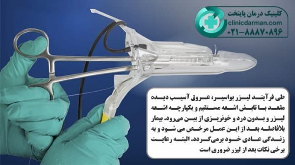  درمان بواسیر یا هموروئید با لیزر