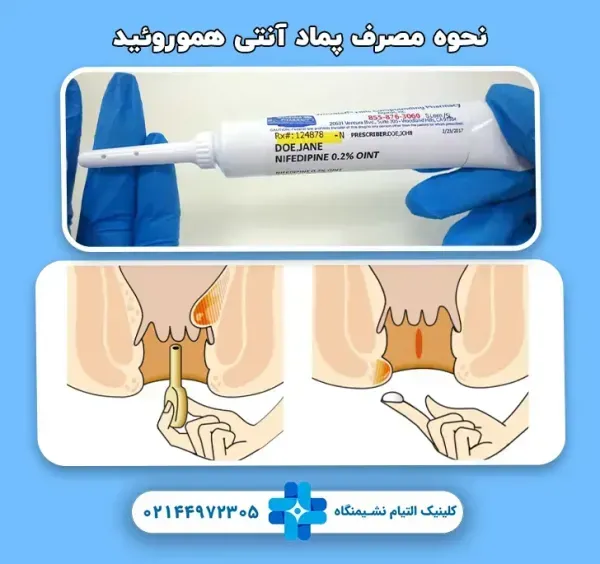  بهترین پماد آنتی هموروئید(بواسیر)