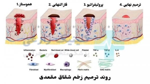  برای درمان بواسیر باید پیش چه دکتری رفت؟