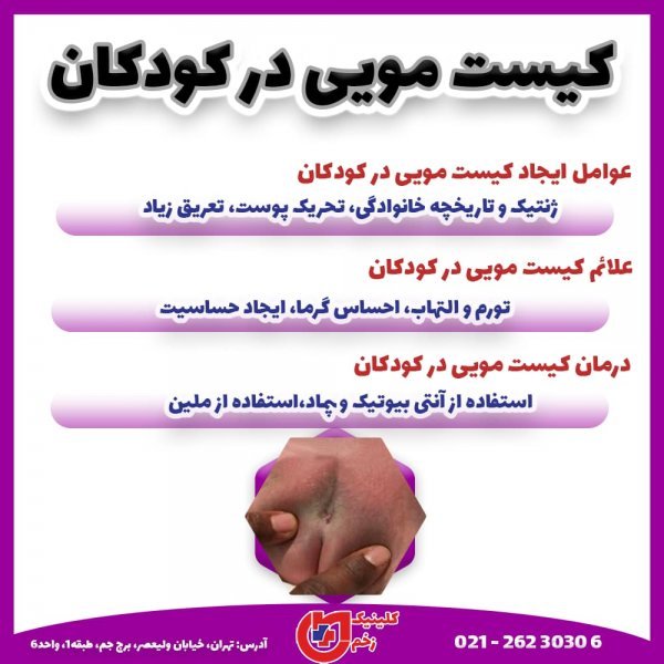  عکس و فیلم کیست مویی در کشاله ران+ زیربغل