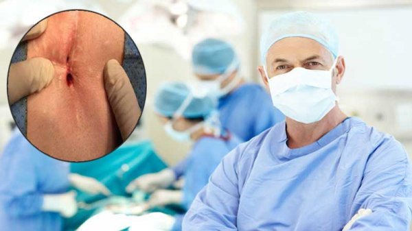 برای کیست مویی چه دکتری باید رفت؟