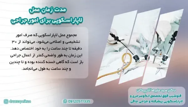  فیلم عمل کیست تخمدان با لیزر