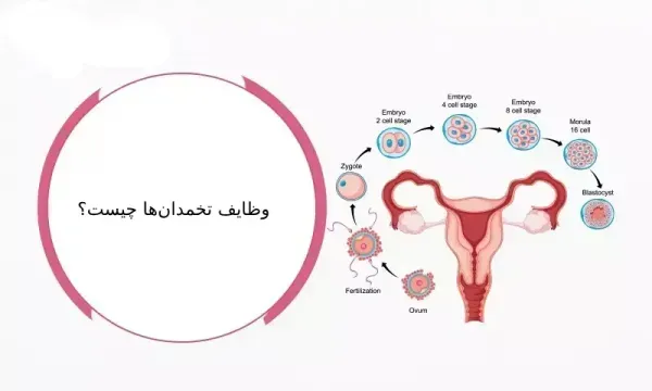  فیلم عمل کیست تخمدان با لیزر