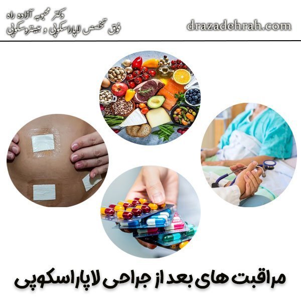  فیلم عمل کیست تخمدان با لیزر