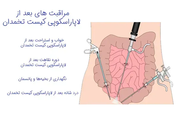  فیلم عمل کیست تخمدان با لیزر