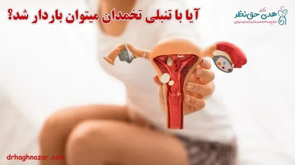 آیا با وجود کیست و تنبلی تخمدان میتوان باردار شد؟