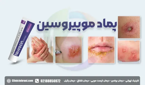  پماد موپیروسین ۲ درصد برای چیست