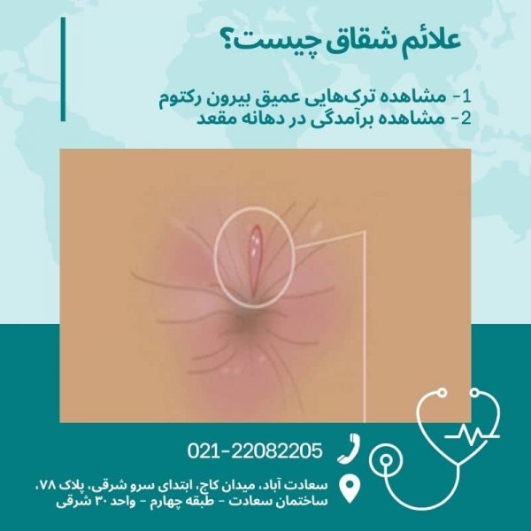  عکس شقاق و بواسیر