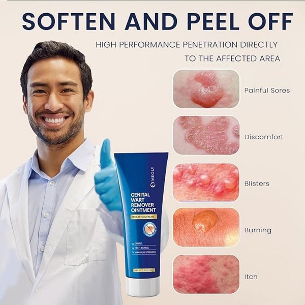  قیمت اسید سالیسیلیک برای زگیل تناسلی/قطره زگیل