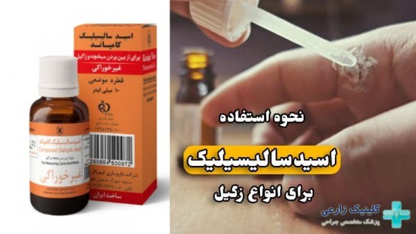 قیمت اسید سالیسیلیک برای زگیل تناسلی/قطره زگیل